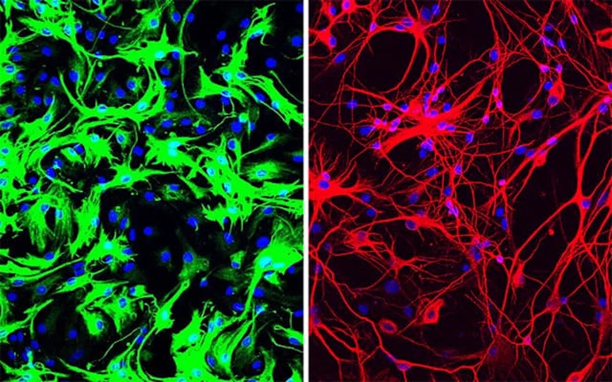 Mouse astrocytes (green) before reprogramming on the left, and on the right after being converted into neurons