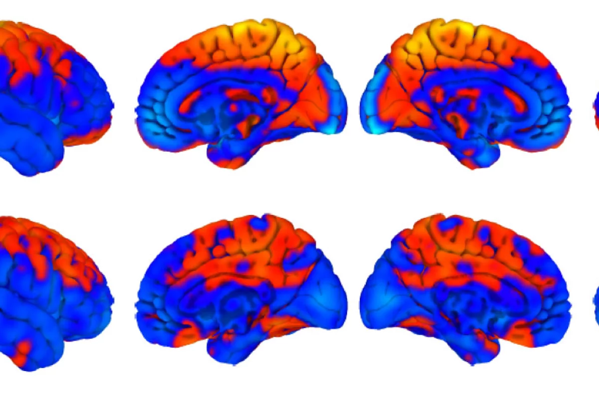 A new study has found that space travel changes the volume of gray matter in the brains of astronauts