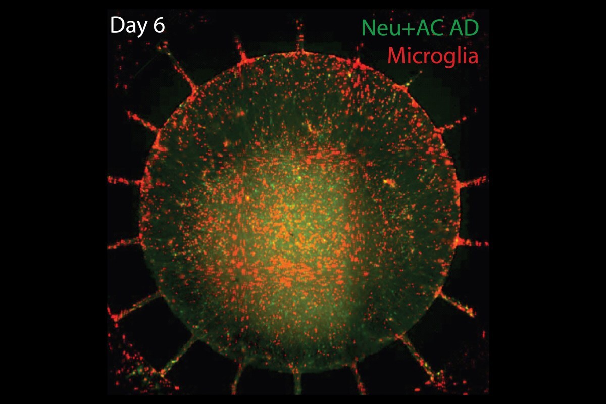 Six days after the nervous system immune cells were introduced to the "Alzheimer's-in-a-dish" culture, 20 percent of the neurons and supporting cells had died