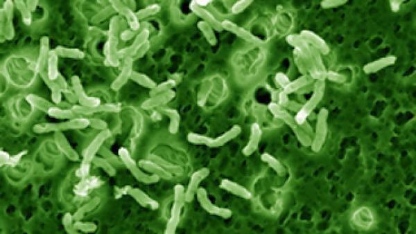 Mycobacterium vaccae