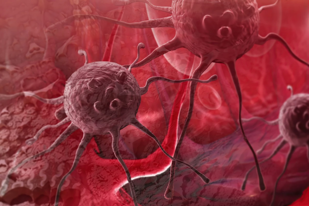 It's estimated a novel drug could help around five percent of patients with glioblastomas carrying a specific protein biomarker