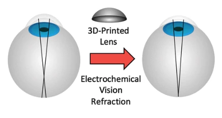 Illustration of EMR