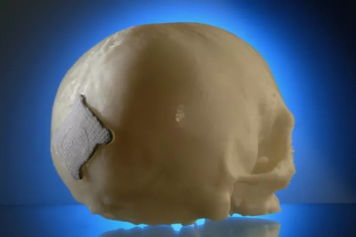 A Resobone patch on a model skull