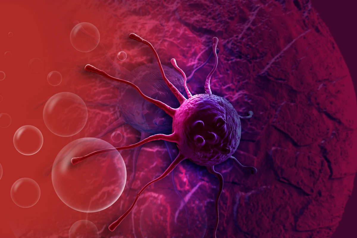 Mutations in the KRAS gene are associated with pancreatic cancer, but a new study has found a way to fight them