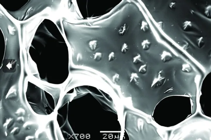 A scanning electron microscope image of the nanowire-alginate composite scaffolds, showing the star-shaped clusters of nanowires (Image: Disease Biophysics Group, Harvard University)