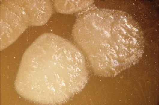 Clostridium Botulinum spores