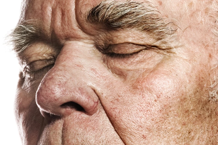 A declining sense of smell may be an earlier indicator of Alzheimer's disease
