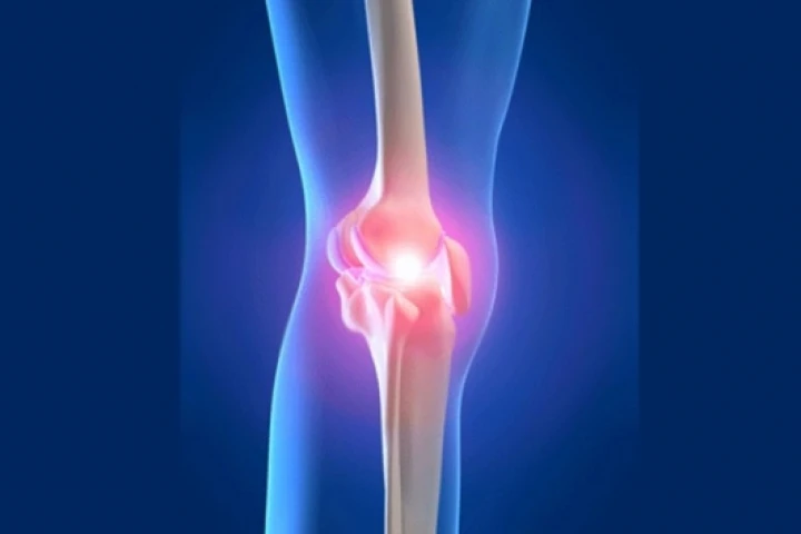 The new scaffold mimics bone and cartilage when implanted into a joint