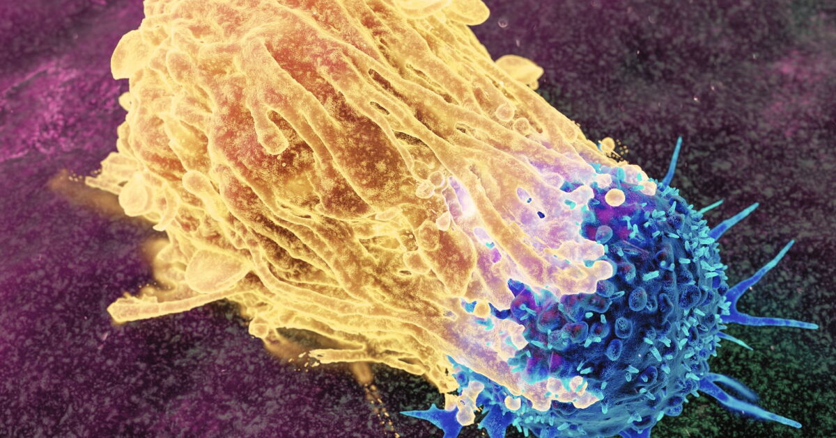 An overlooked immune cell offers a way to treat deadliest lung cancers