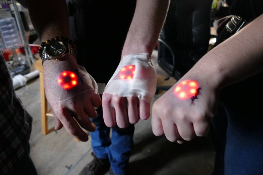 The first iteration of the Northstar, a glowing LED implant