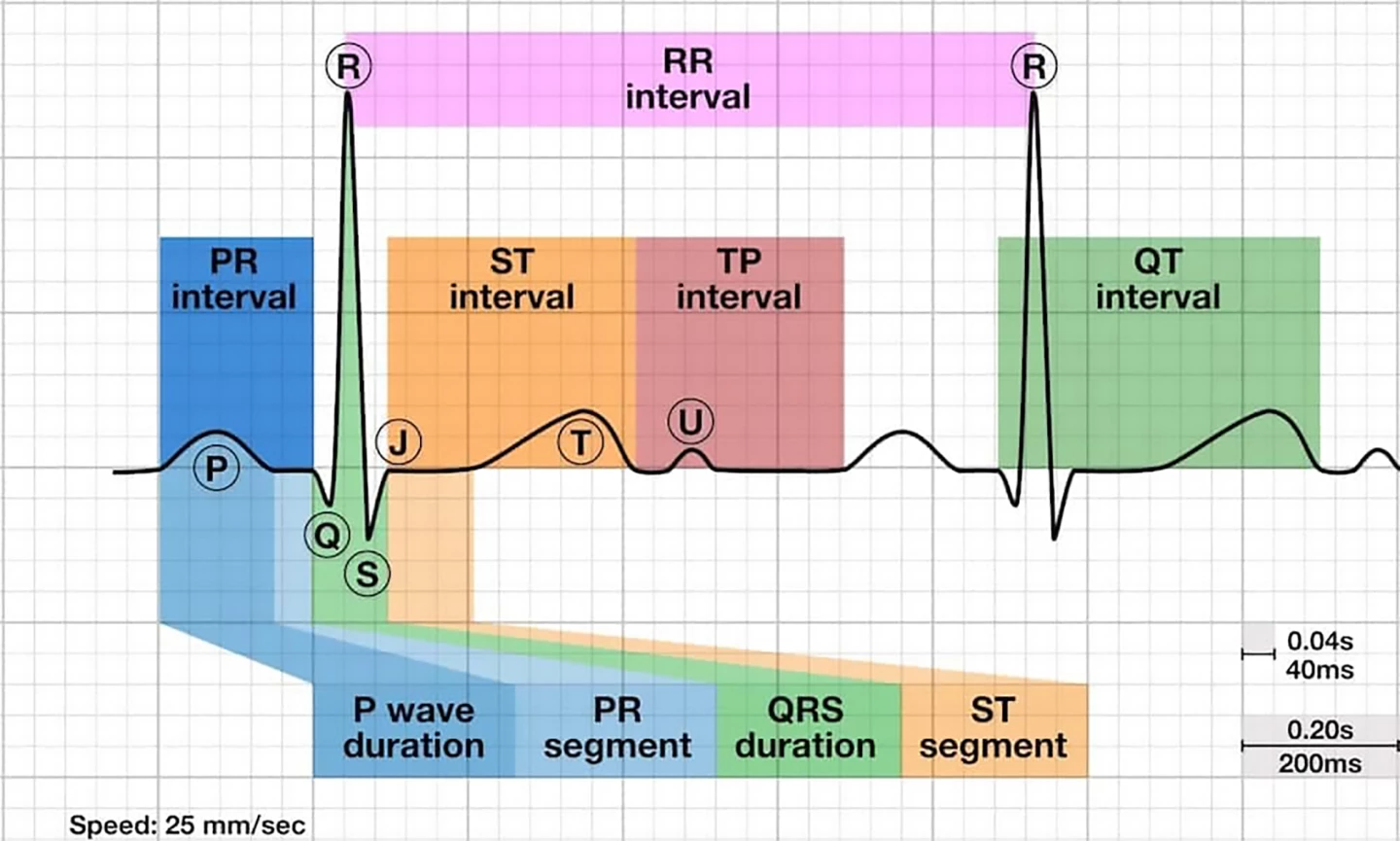 The ECG wave, segments and intervals