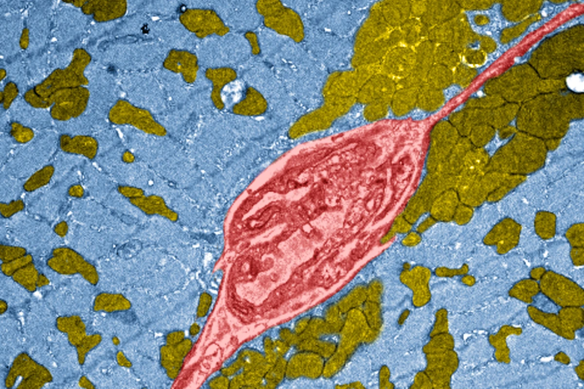 Pumped-up muscle tissue (in blue) in a high performing "mighty mouse"