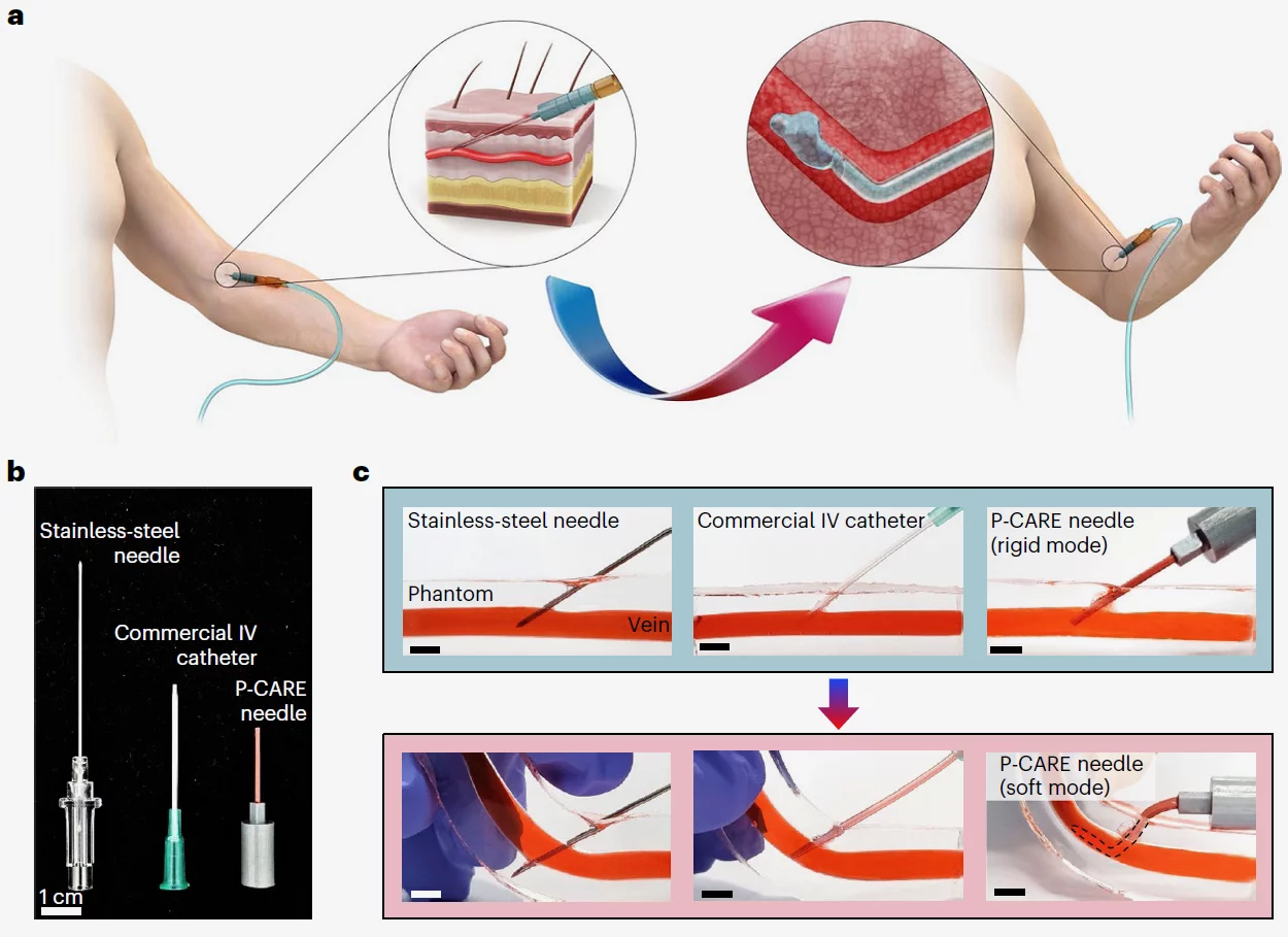 A diagram illustrating how the P-CARE needle is inserted, and how it differs from conventional rigid needles
