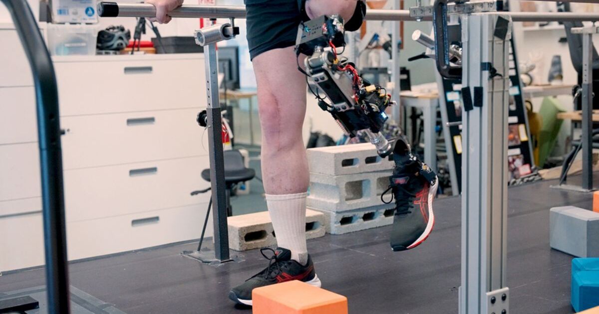 MIT’s bionic knee offers natural movement for amputees MIT’s bionic knee offers natural movement for amputees