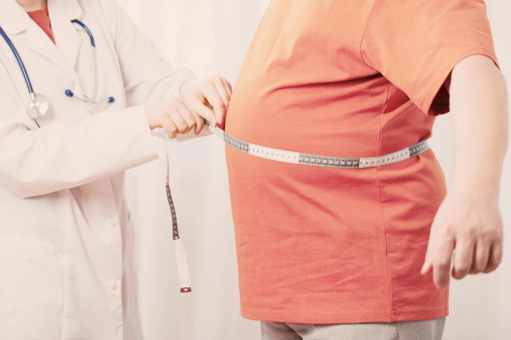 With cancer, an overweight past may come back to haunt you