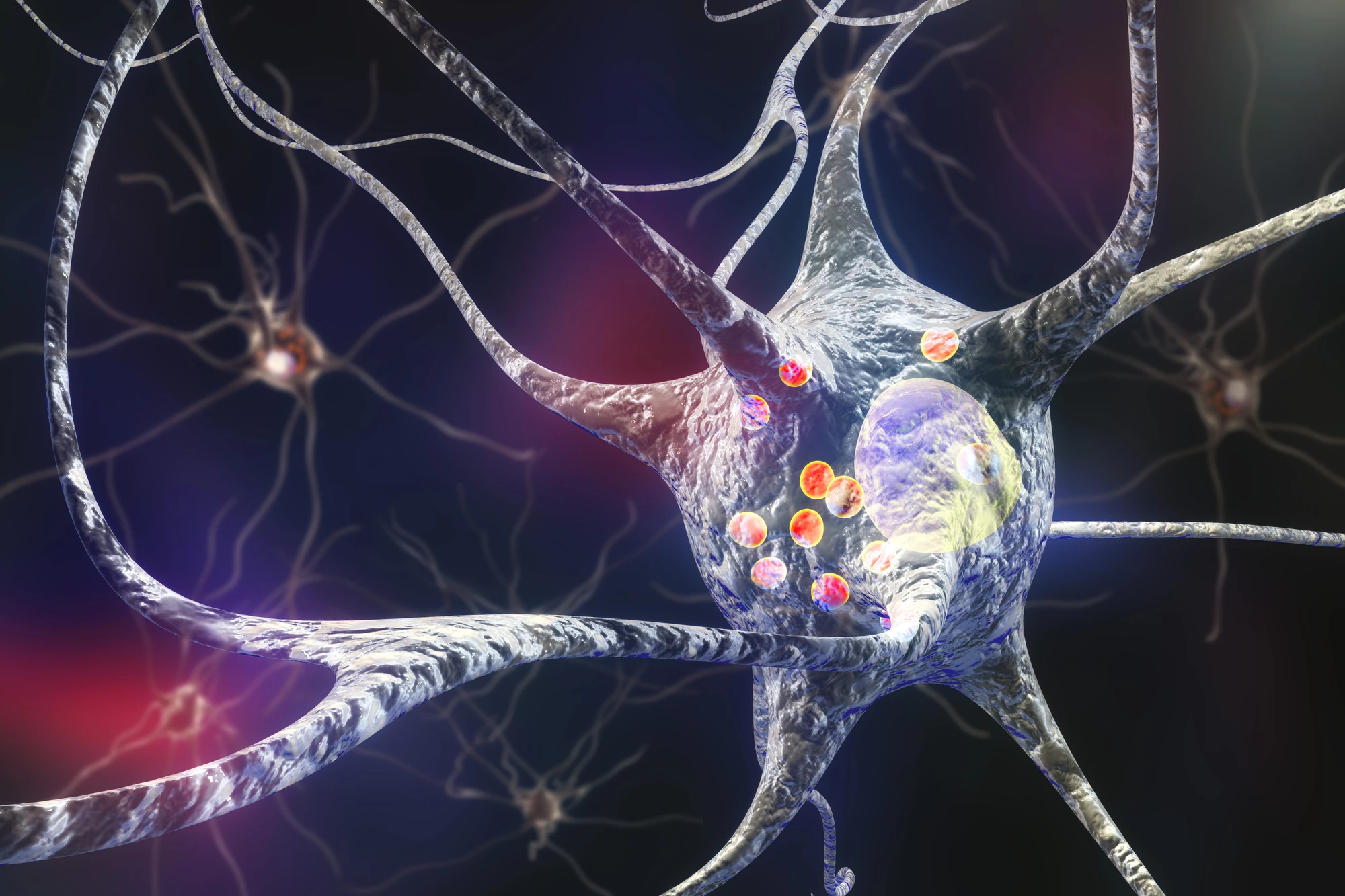 Queensland researchers have discovered that the gene mutation that increases the risk of Parkinson's disease also causes a build-up of debris in brain cells