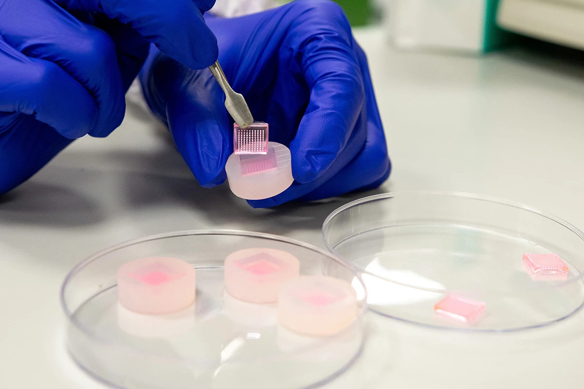 Microneedles on a sponge-like polymer can effectively deliver medication into chronic wounds, and safely dissolve into them too