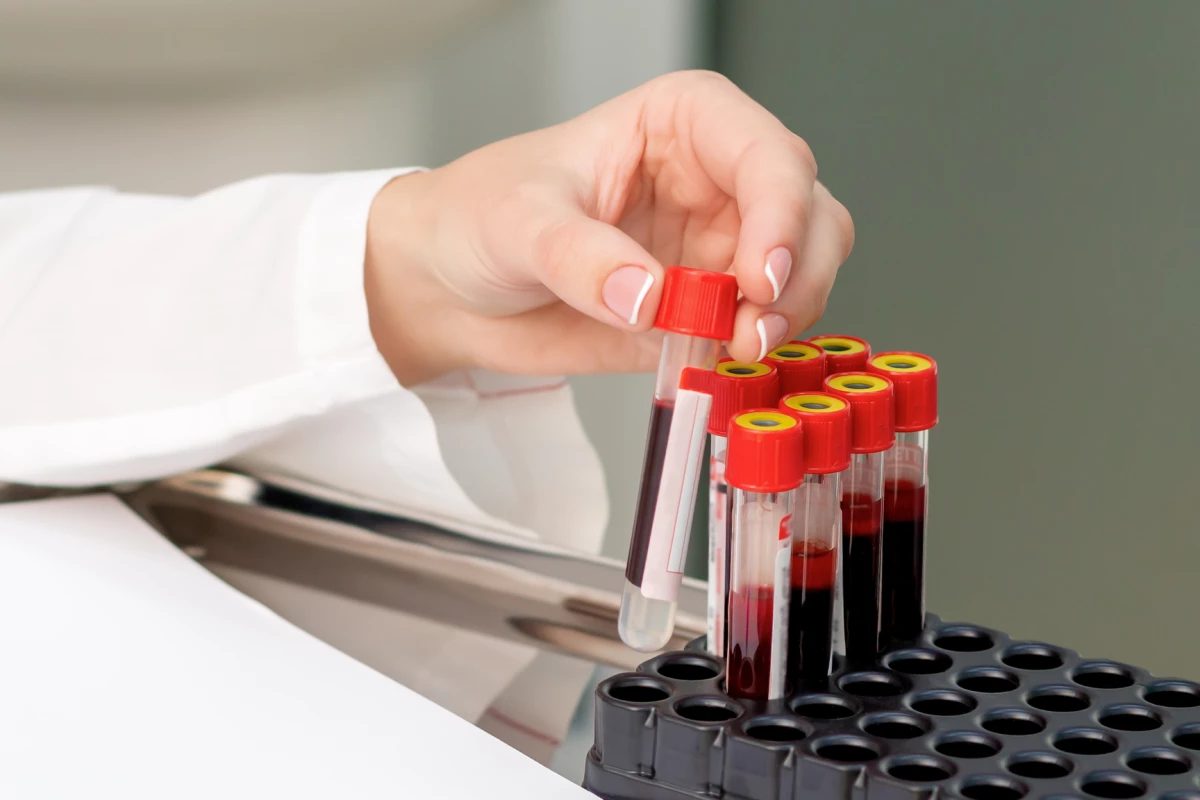 A proof-of-concept study demonstrates a novel blood test that can distinguish between depression and bipolar disorder while also pointing at the most effective treatment for each individual patient