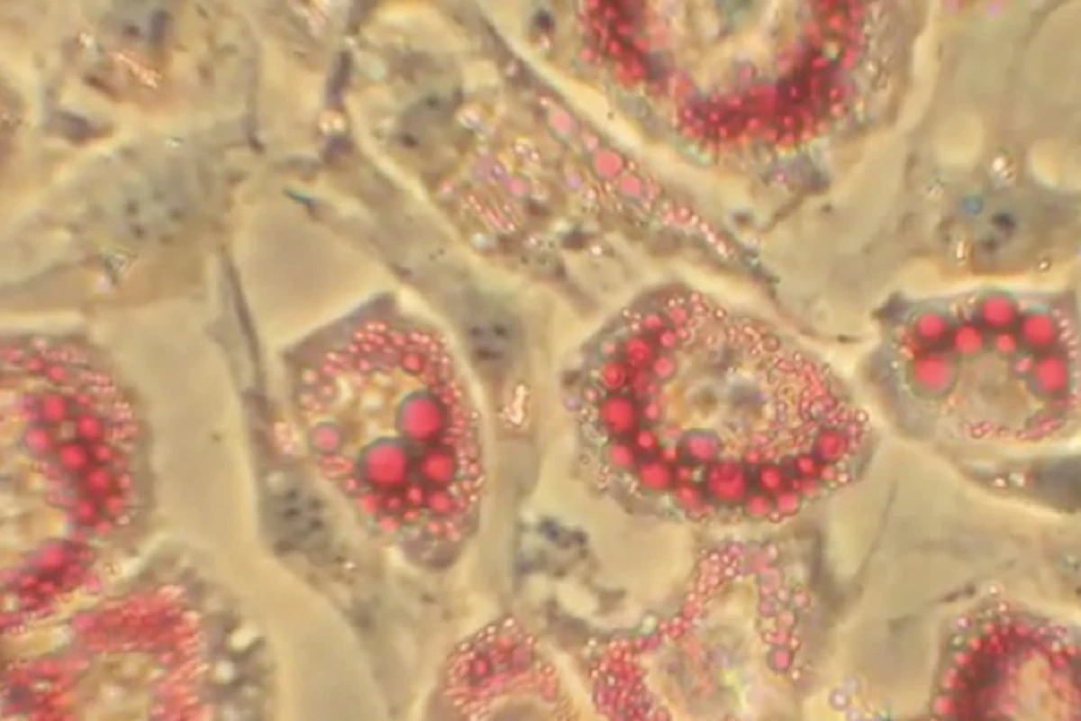 Specially-treated fat cells may one day lead to weight loss