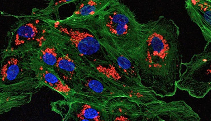 A microscopic image of endothelial cells treated with drug-loaded nanoparticles