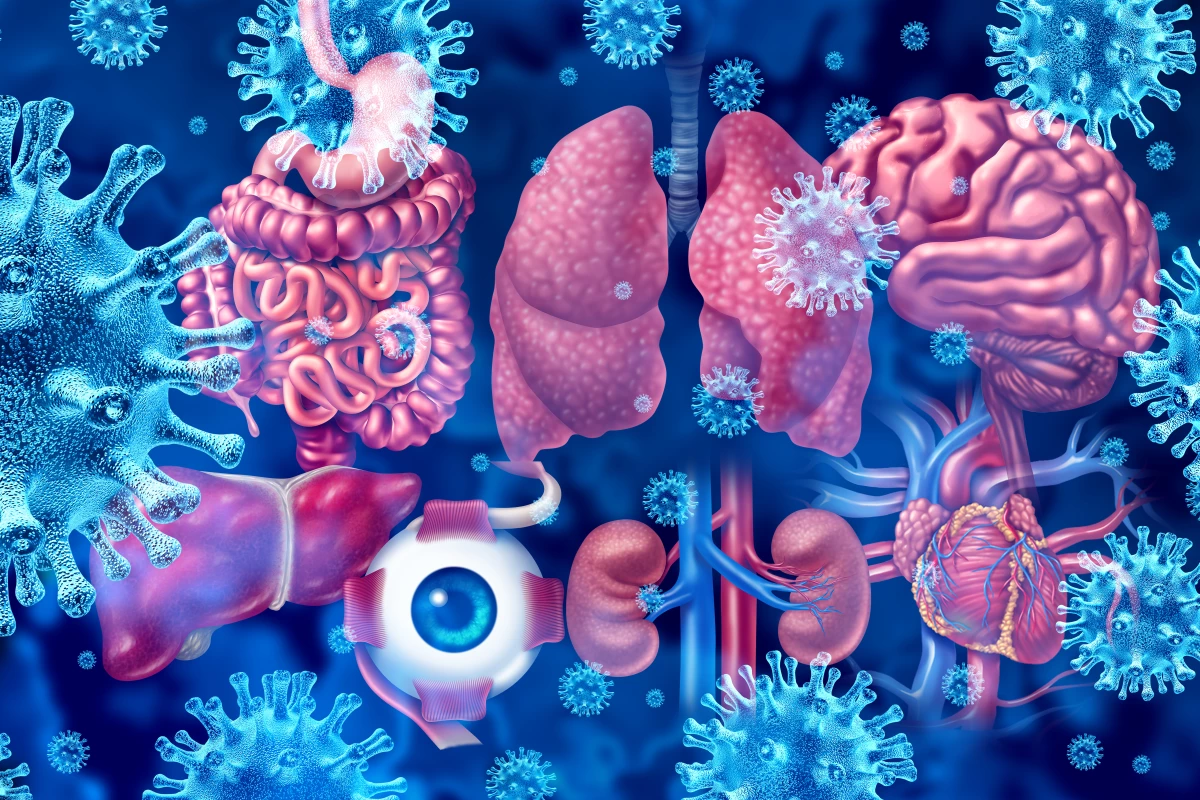 Researchers are attempting to understand the risk factors that make different people more susceptible to various long COVID symptoms