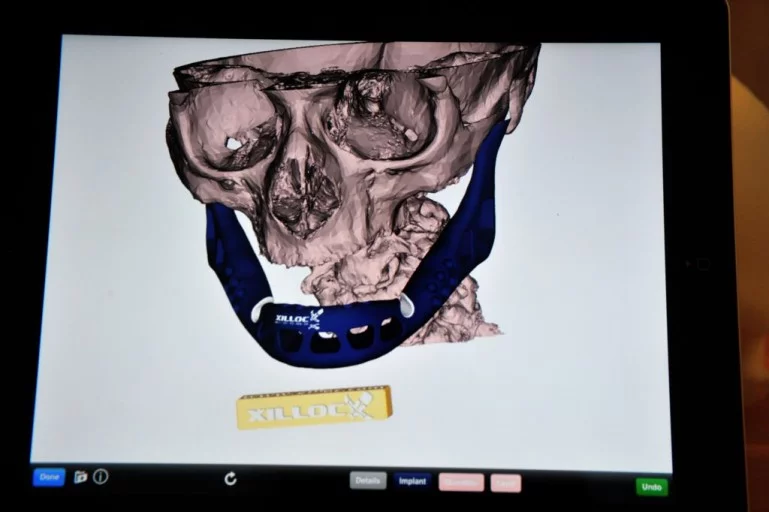 3D printing allows for a custom, snug fit