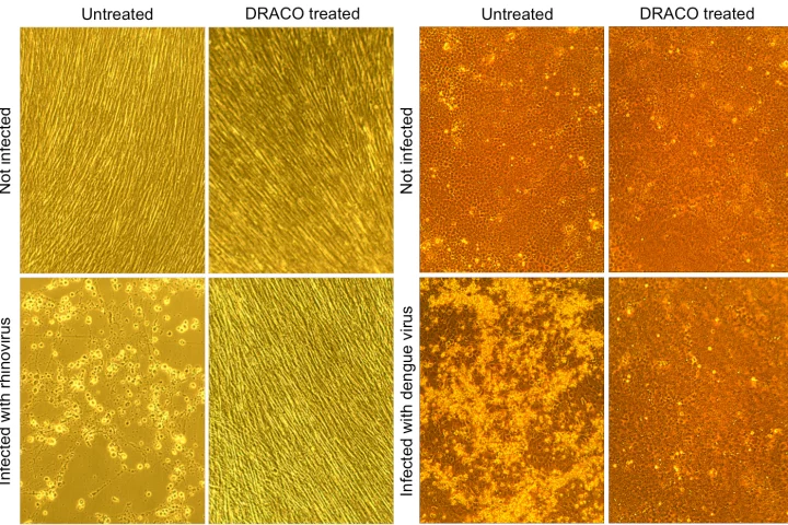 In this set of four photos, dengue hemorrhagic fever virus kills untreated monkey cells (lower left), whereas DRACO has no toxicity in uninfected cells (upper right) and cures an infected cell population (lower right) - (Image: MIT)