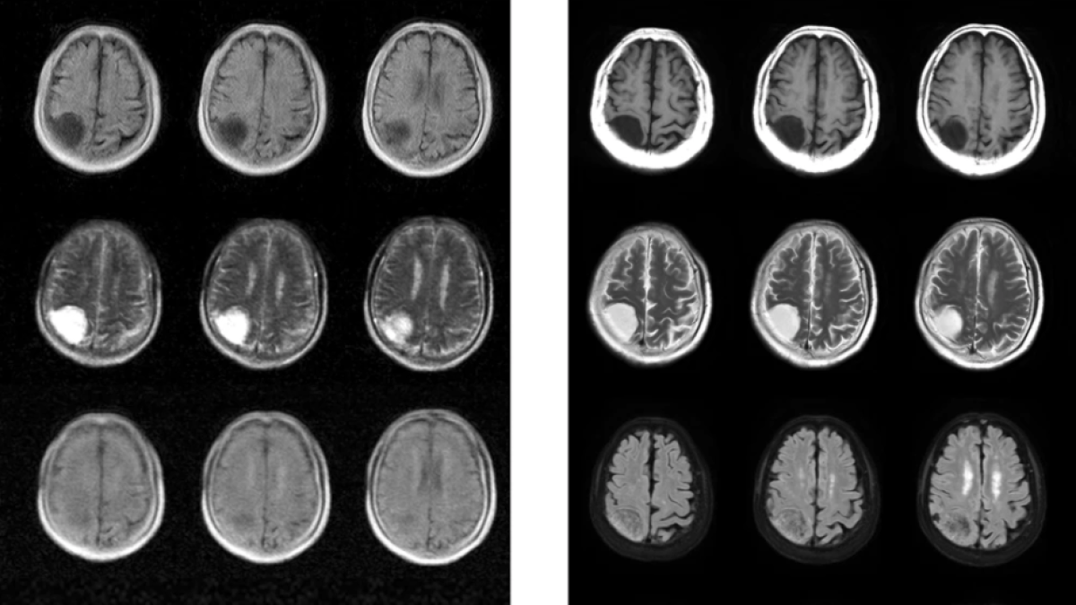 MRI machine detects brain disorders at a fraction of the cost