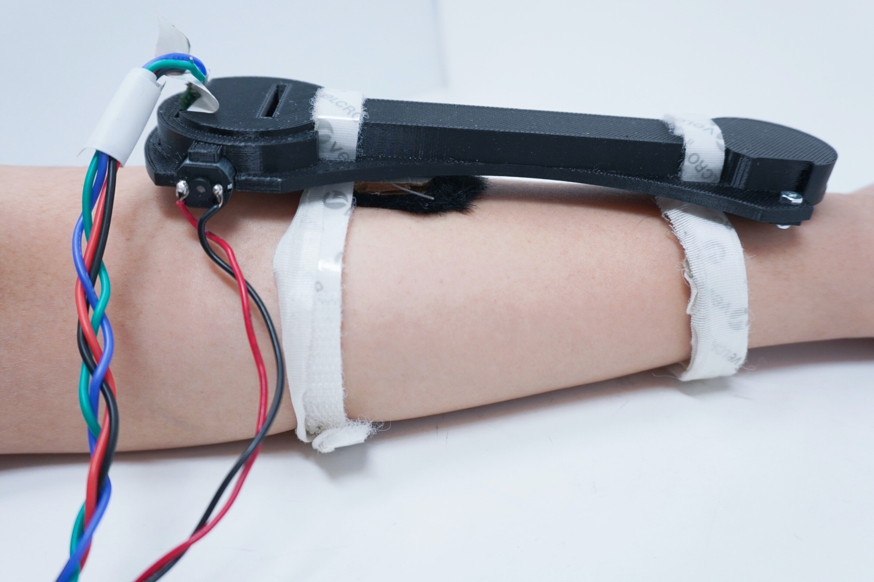 Armstroking wearable found to reduce perceived stress and anxiety