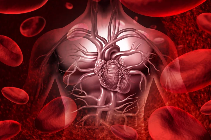 The course of blood through the heart might be a critical indicator of stroke risk