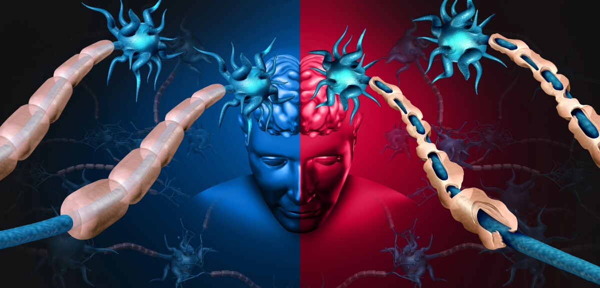 What if multiple sclerosis isn't just one disease?