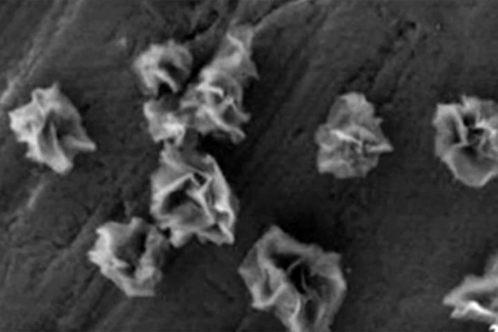 These metallic nanoflowers have huge potential as neuroprotective agents