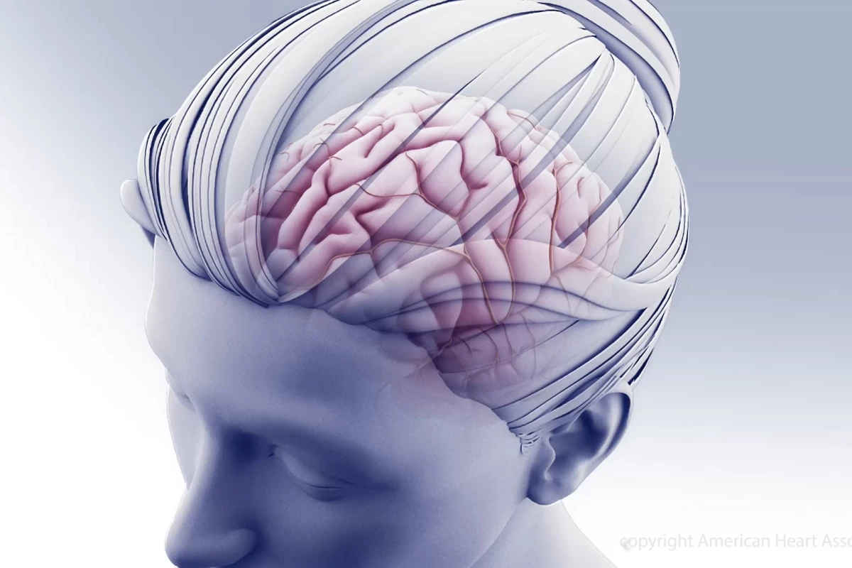 Subjects undergoing treatment for high blood pressure demonstrated slower rates of cognitive decline compared to those with untreated high blood pressure