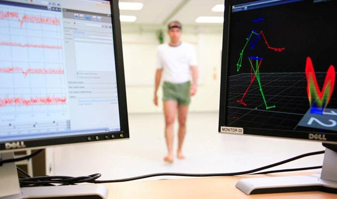 A new study suggests a person's gait can be used to distinguish between Alzheimer's dementia and Lewy body dementia