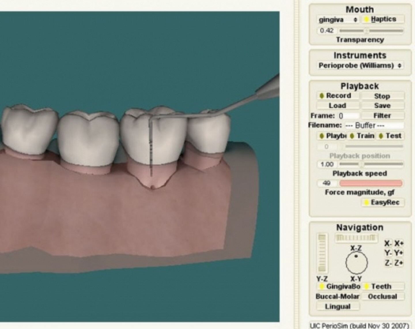 3D virtual reality dental simulator