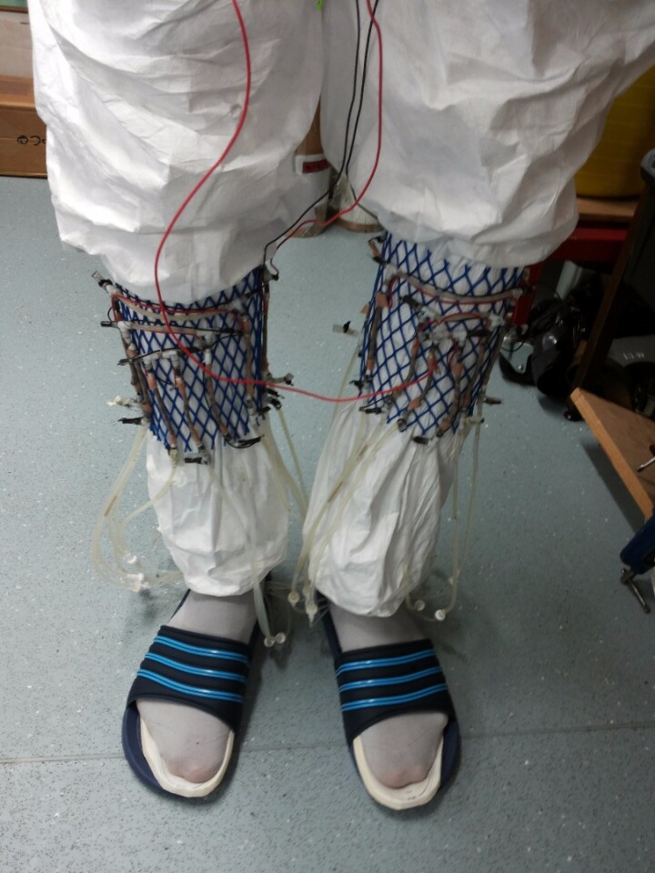 The experimental urine-powered socks