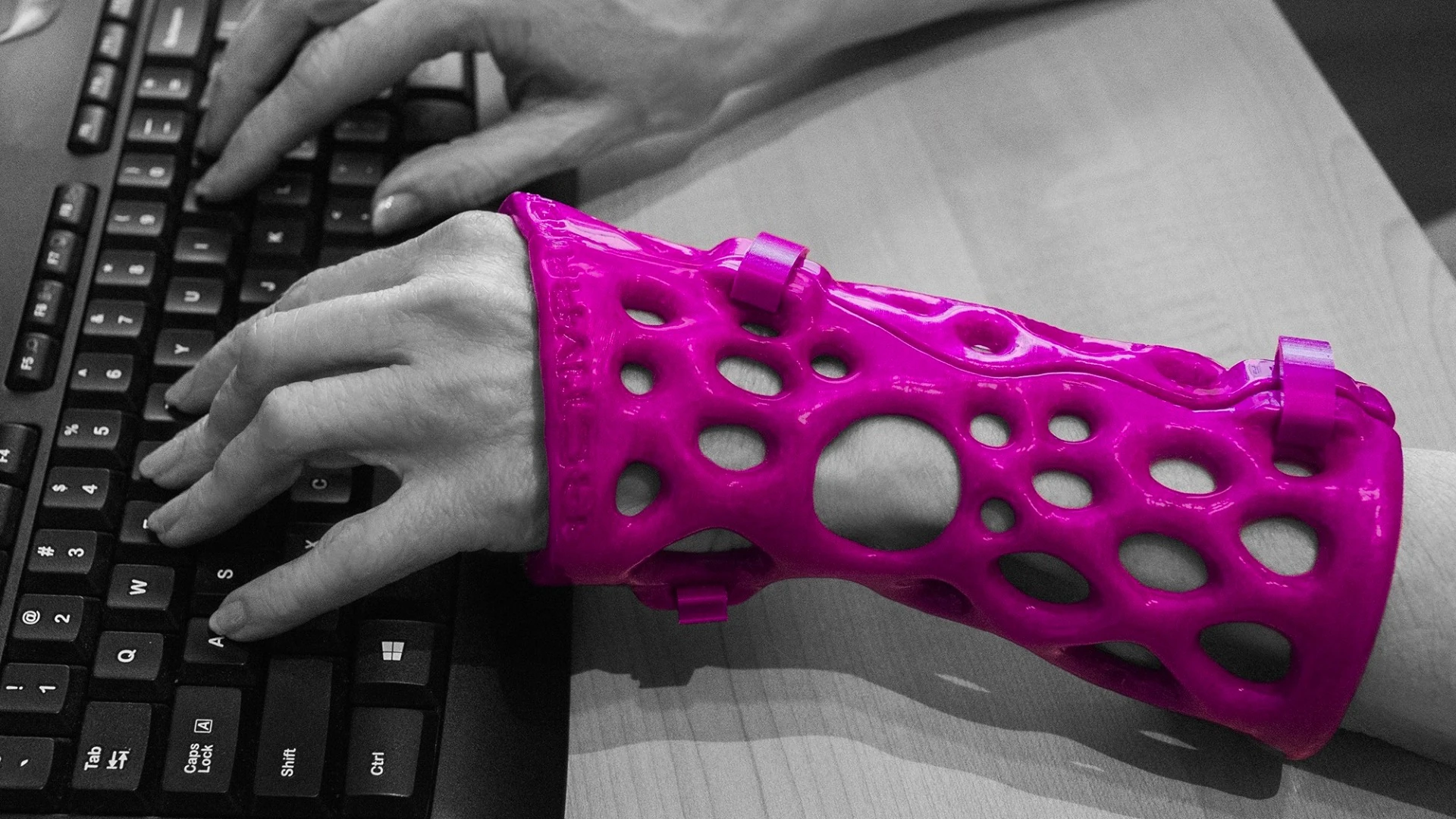 The ActivArmor support device takes the place of a cast or brace