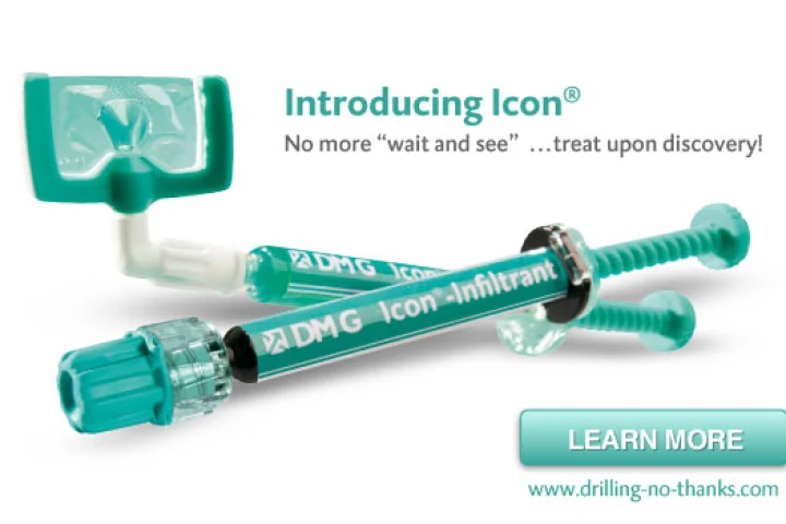 Homepage for DMG's Icon cavity infiltration system