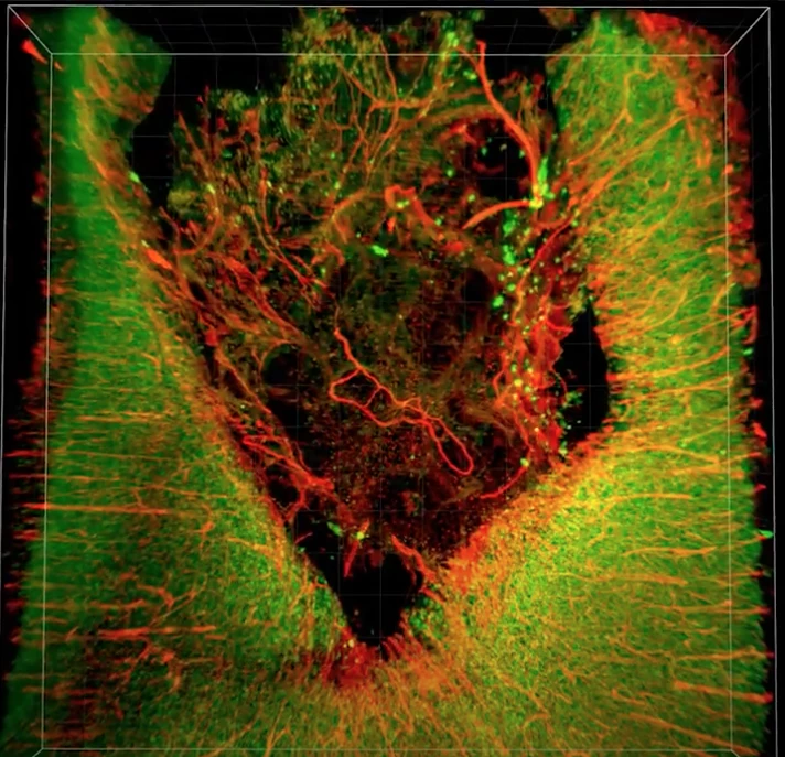 3D image of a injured rat brain treated with a newly developed "brain glue," with neurons seen in green and the blood vessels seen in red. Active neurons and healthy blood vessels can be seen in the injury cavity in the center, as evidence of healing.