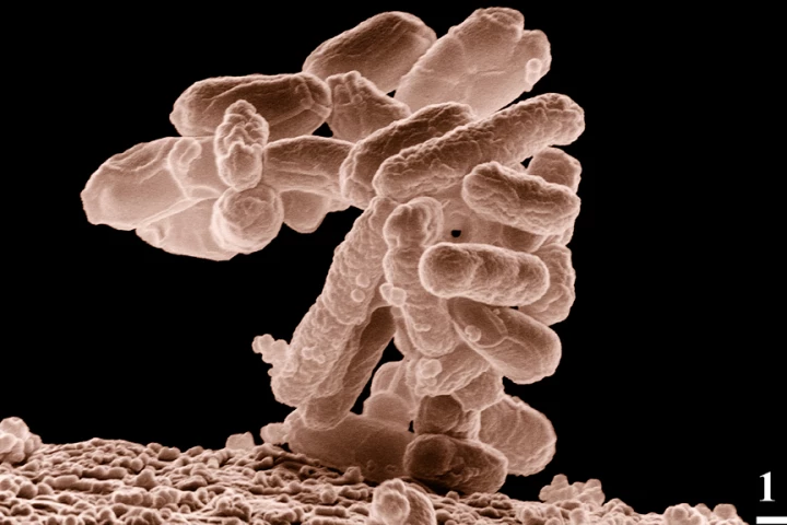 New paper strips detect Escherichia coli simply, cheaply and quickly