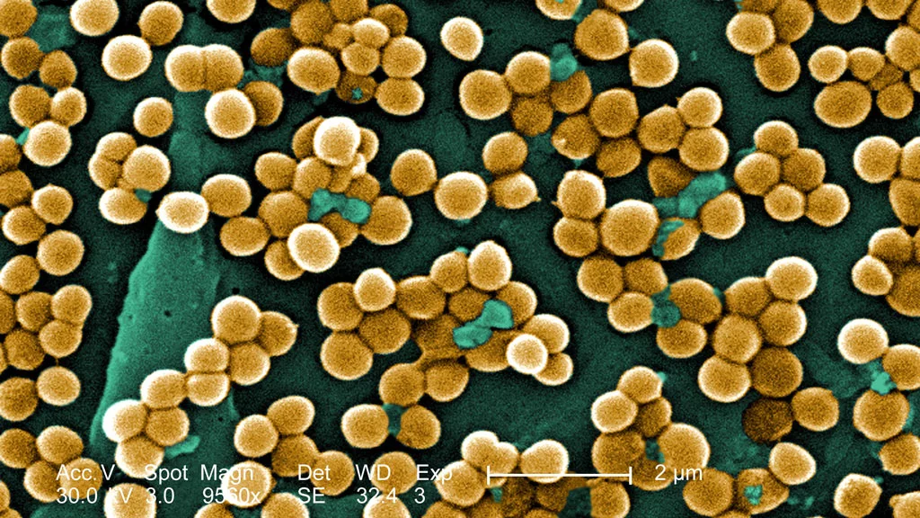 MRSA (methicillin-resistant Staphylococcus Aureus) and other drug-resistant bacteria could face annihilation from low-temperature plasma devices