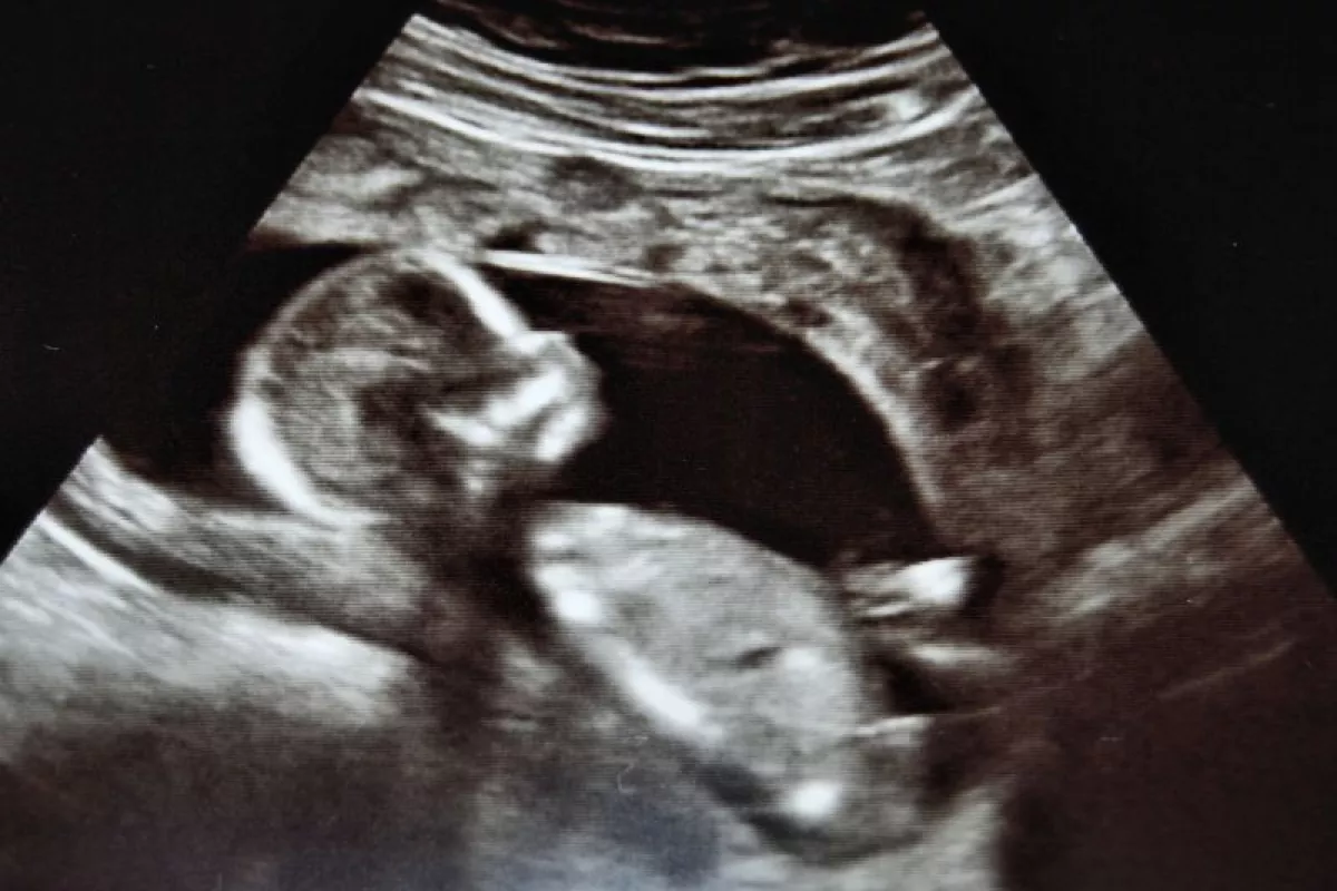 A newly developed acoustic rectifier could improve the image quality of sonograms (Photo: myllissa via Flickr)