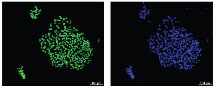 Marker staining of hiPSCs (Photo: Loh Yuin Han, Jonathan, IMCB)