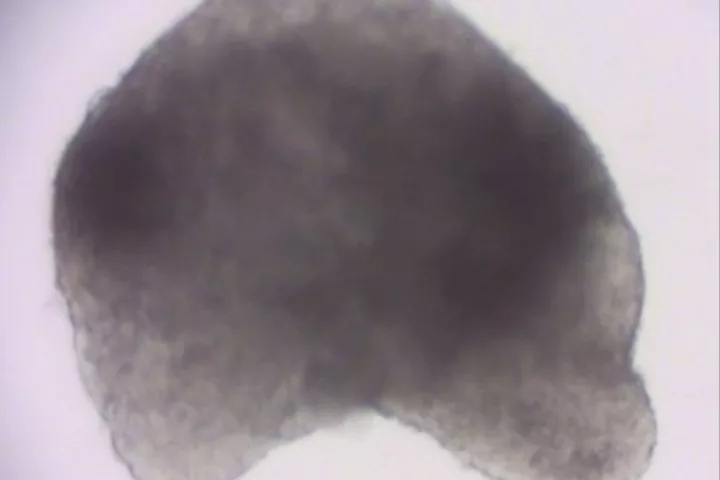 A mouse heart grown in a lab dish from stem cells