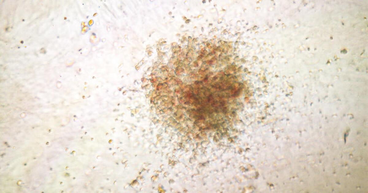 New gene editing tool reduces errors by nicking DNA not cutting