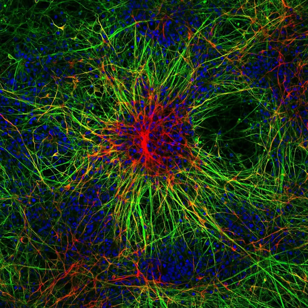 Image of Distinction: Human skin cells reprogrammed and differentiated into neurons showing nuclei (blue) and inter-neuronal network (green and red)