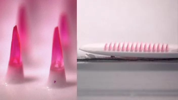 Dissolving microneedle vaccines: cheaper, less painful, less dangerous and more effective than a syringe