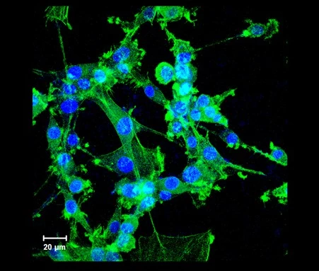 A microscope image of neural cells that have been frozen with the new cryoprotectant and thawed again