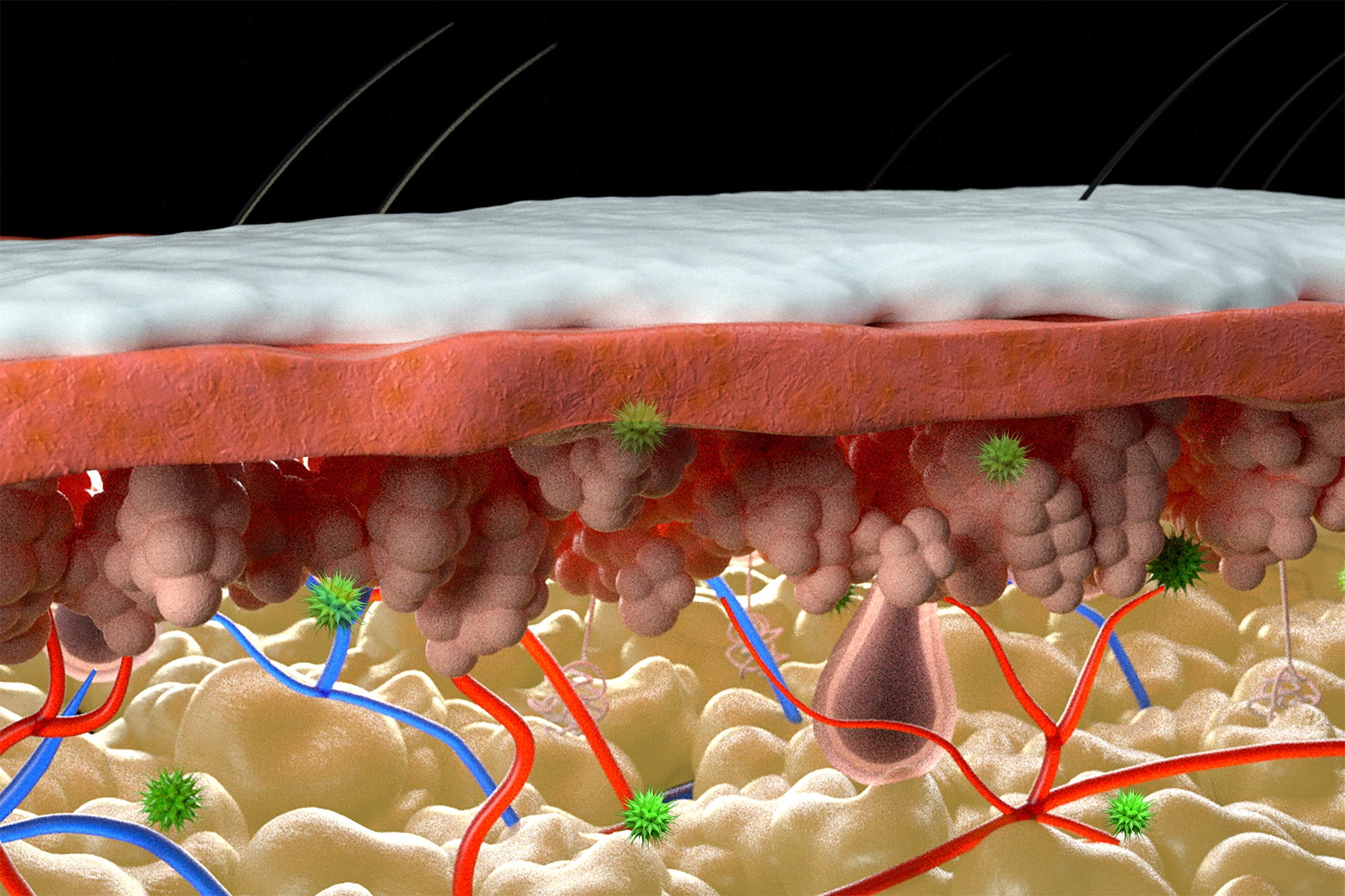 The synthetic melanin cream sits on top of inflamed skin and soaks up the free radicals (green) beneath the surface