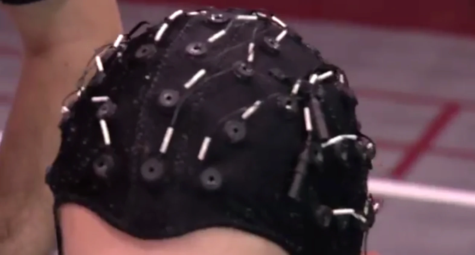 The EEG skullcap